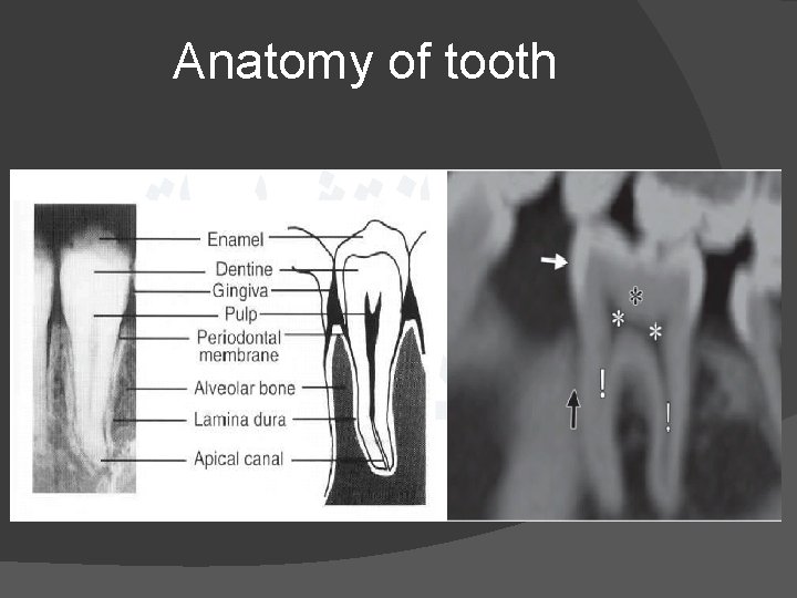 Anatomy of tooth 