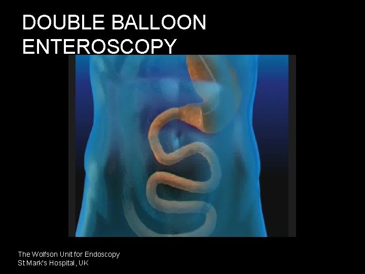 DOUBLE BALLOON ENTEROSCOPY The Wolfson Unit for Endoscopy St Mark's Hospital, UK 