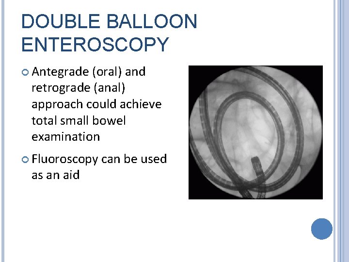 DOUBLE BALLOON ENTEROSCOPY Antegrade (oral) and retrograde (anal) approach could achieve total small bowel