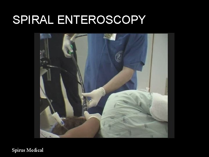 SPIRAL ENTEROSCOPY Spirus Medical 