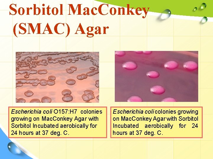 Sorbitol Mac. Conkey (SMAC) Agar Escherichia coli O 157: H 7 colonies growing on