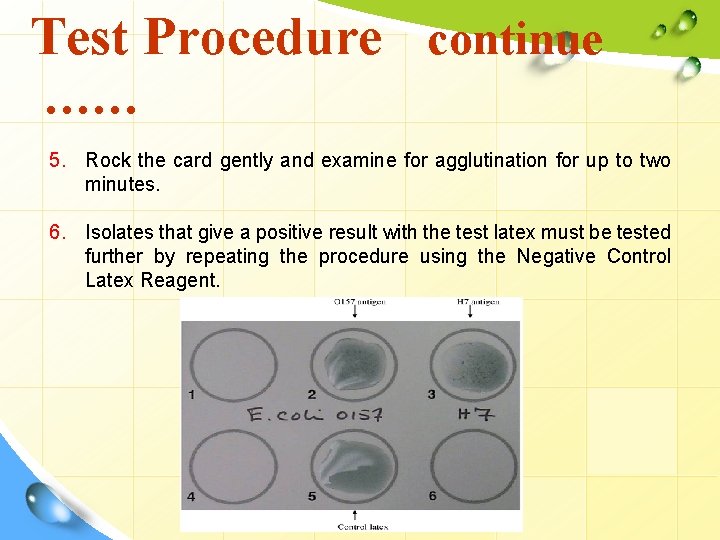 Test Procedure continue …… 5. Rock the card gently and examine for agglutination for