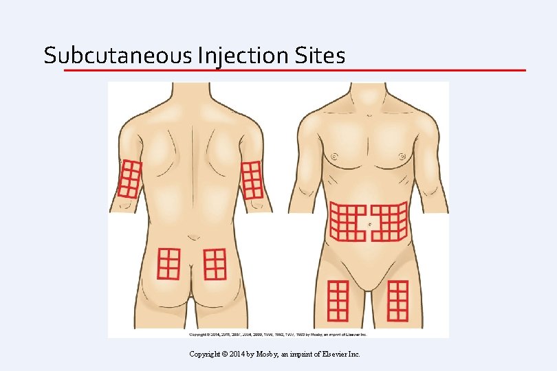 Subcutaneous Injection Sites Copyright © 2014 by Mosby, an imprint of Elsevier Inc. 