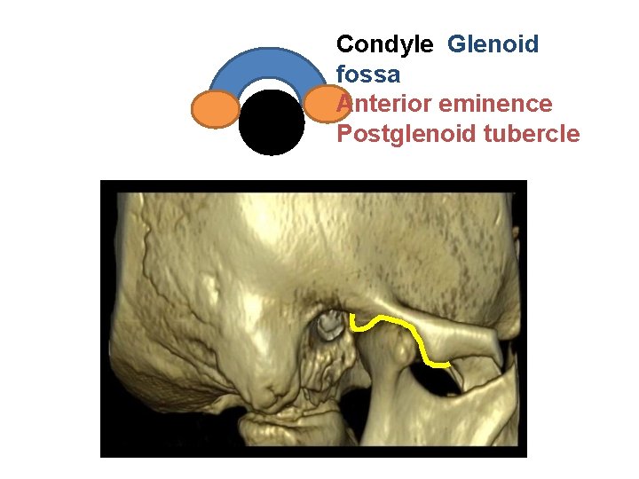 Condyle Glenoid fossa Anterior eminence Postglenoid tubercle 