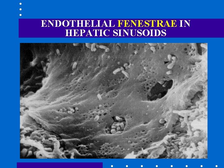 ENDOTHELIAL FENESTRAE IN HEPATIC SINUSOIDS 