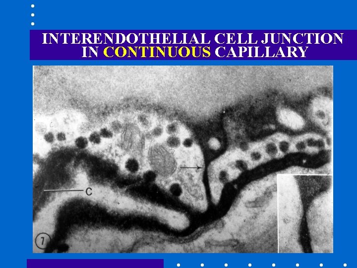 INTERENDOTHELIAL CELL JUNCTION IN CONTINUOUS CAPILLARY 