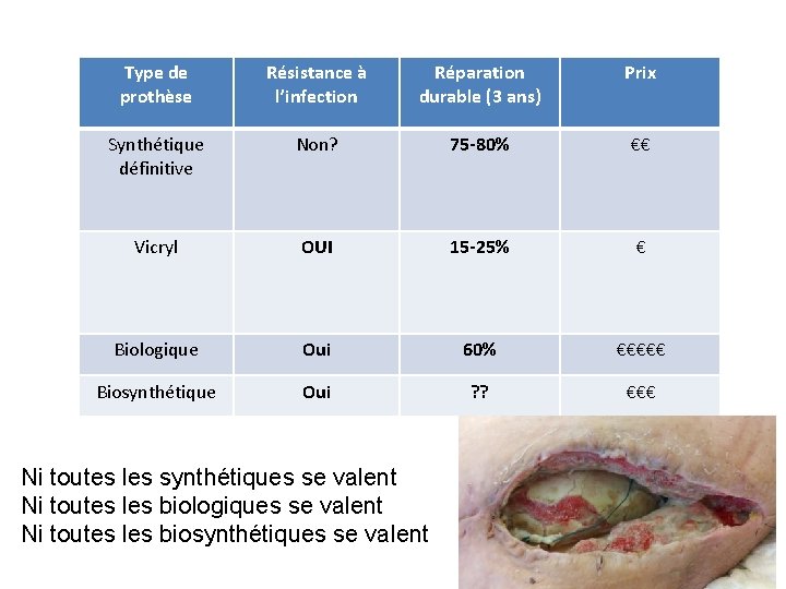 Type de prothèse Résistance à l’infection Réparation durable (3 ans) Prix Synthétique définitive Non?