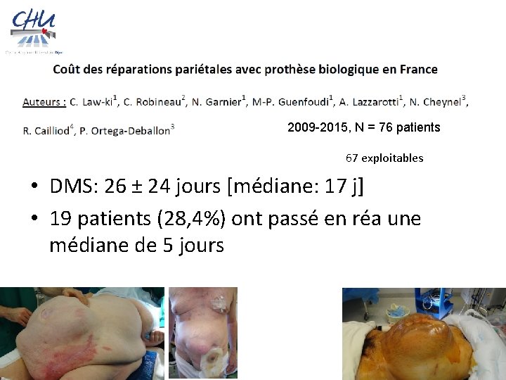 2009 -2015, N = 76 patients 67 exploitables • DMS: 26 ± 24 jours