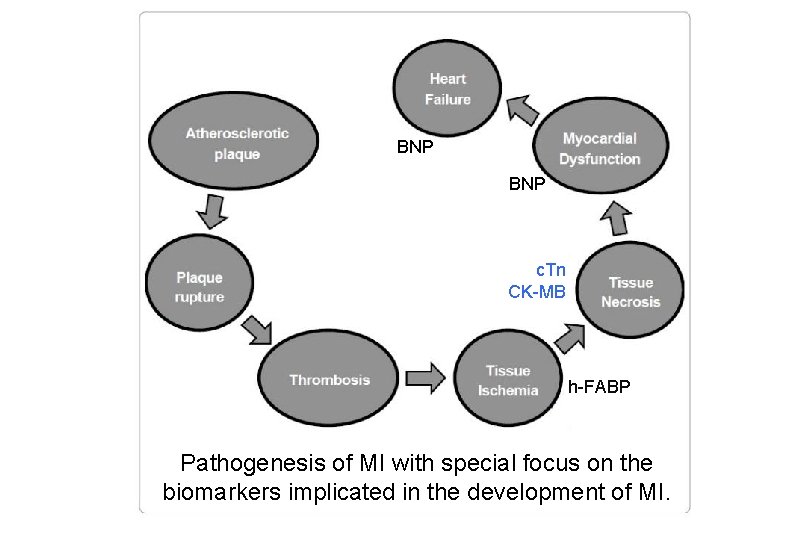 BNP c. Tn CK-MB h-FABP Pathogenesis of MI with special focus on the biomarkers