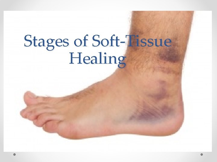 Stages of Soft-Tissue Healing 