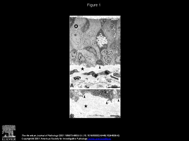 Figure 1 The American Journal of Pathology 2001 158673 -680 DOI: (10. 1016/S 0002