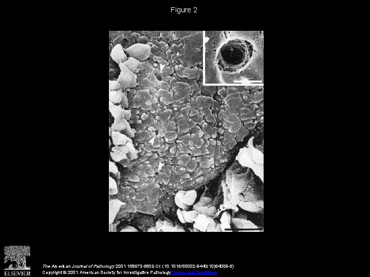 Figure 2 The American Journal of Pathology 2001 158673 -680 DOI: (10. 1016/S 0002