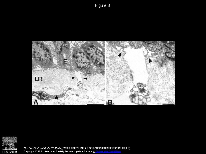 Figure 3 The American Journal of Pathology 2001 158673 -680 DOI: (10. 1016/S 0002