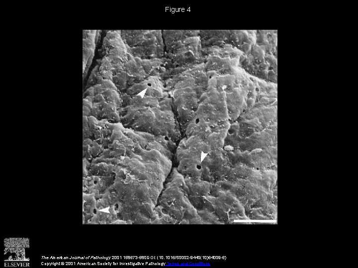 Figure 4 The American Journal of Pathology 2001 158673 -680 DOI: (10. 1016/S 0002