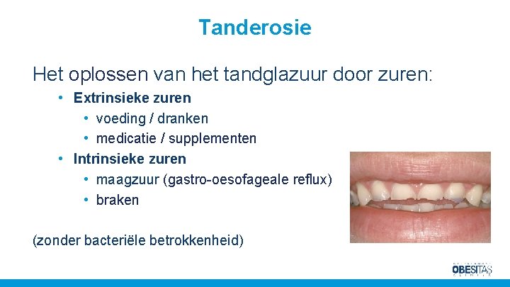 Tanderosie Het oplossen van het tandglazuur door zuren: • Extrinsieke zuren • voeding /