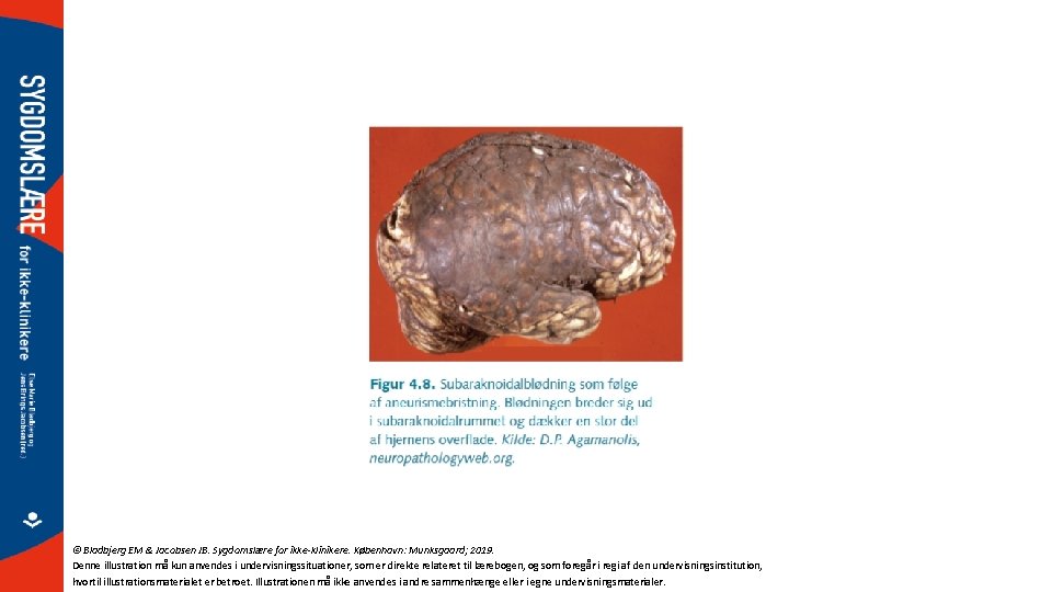 © Bladbjerg EM & Jacobsen JB. Sygdomslære for ikke-klinikere. København: Munksgaard; 2019. Denne illustration