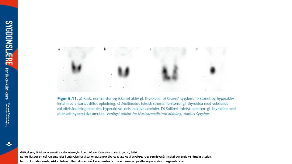 © Bladbjerg EM & Jacobsen JB. Sygdomslære for ikke-klinikere. København: Munksgaard; 2019. Denne illustration