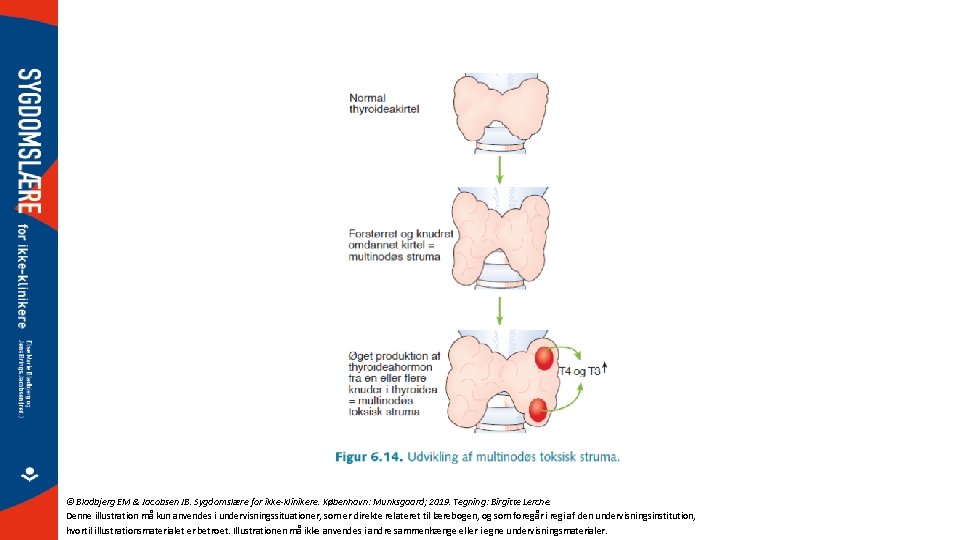 © Bladbjerg EM & Jacobsen JB. Sygdomslære for ikke-klinikere. København: Munksgaard; 2019. Tegning: Birgitte