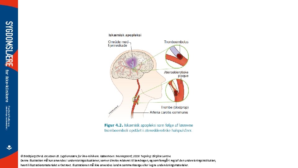 © Bladbjerg EM & Jacobsen JB. Sygdomslære for ikke-klinikere. København: Munksgaard; 2019. Tegning: Birgitte