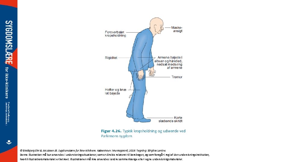 © Bladbjerg EM & Jacobsen JB. Sygdomslære for ikke-klinikere. København: Munksgaard; 2019. Tegning: Birgitte