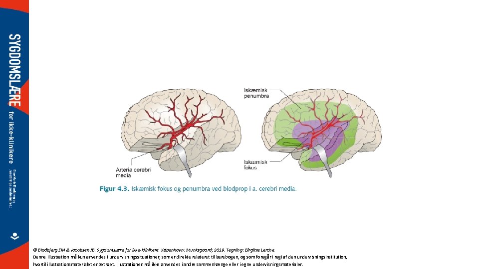© Bladbjerg EM & Jacobsen JB. Sygdomslære for ikke-klinikere. København: Munksgaard; 2019. Tegning: Birgitte