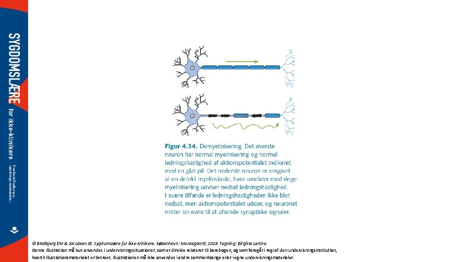 © Bladbjerg EM & Jacobsen JB. Sygdomslære for ikke-klinikere. København: Munksgaard; 2019. Tegning: Birgitte