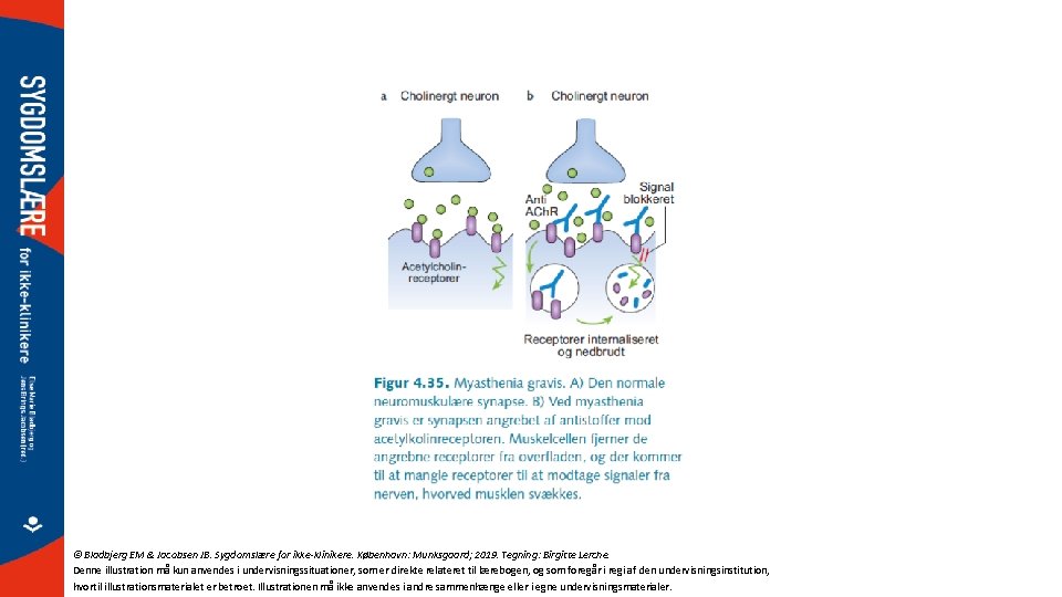 © Bladbjerg EM & Jacobsen JB. Sygdomslære for ikke-klinikere. København: Munksgaard; 2019. Tegning: Birgitte