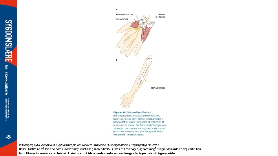 © Bladbjerg EM & Jacobsen JB. Sygdomslære for ikke-klinikere. København: Munksgaard; 2019. Tegning: Birgitte