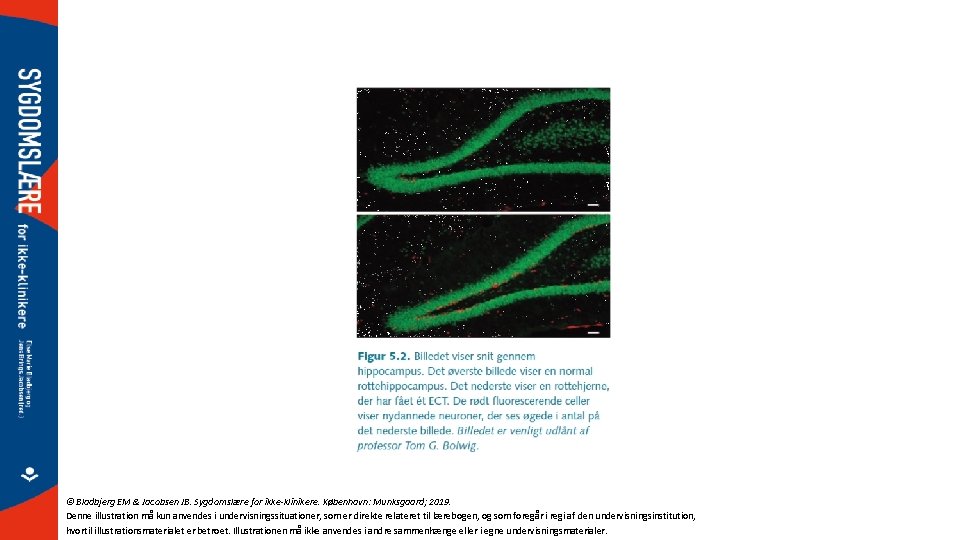 © Bladbjerg EM & Jacobsen JB. Sygdomslære for ikke-klinikere. København: Munksgaard; 2019. Denne illustration