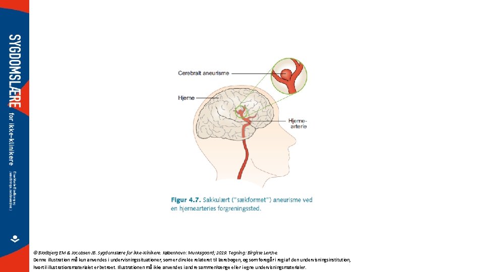 © Bladbjerg EM & Jacobsen JB. Sygdomslære for ikke-klinikere. København: Munksgaard; 2019. Tegning: Birgitte