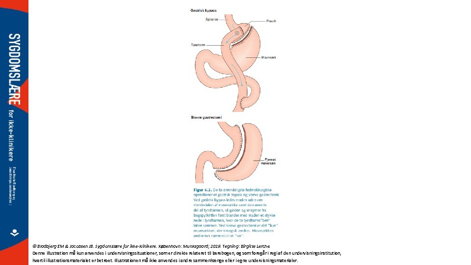 © Bladbjerg EM & Jacobsen JB. Sygdomslære for ikke-klinikere. København: Munksgaard; 2019. Tegning: Birgitte