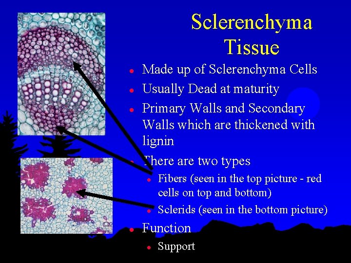 Sclerenchyma Tissue l l Made up of Sclerenchyma Cells Usually Dead at maturity Primary