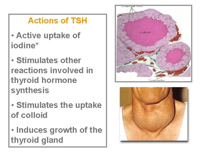 Actions of TSH • Active uptake of iodine* • Stimulates other reactions involved in