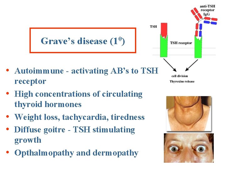 Grave’s disease (10) • Autoimmune - activating AB’s to TSH • • receptor High