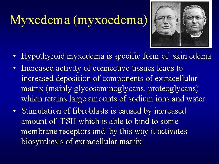 Myxedema (myxoedema) • Hypothyroid myxedema is specific form of skin edema • Increased activity