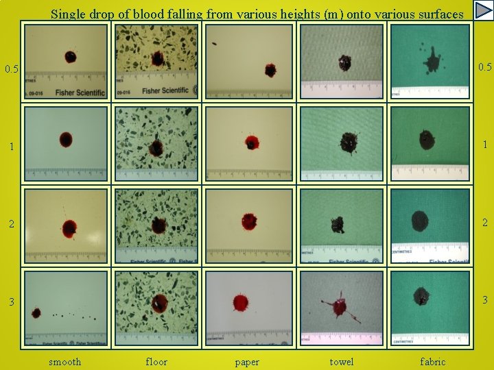 Single drop of blood falling from various heights (m) onto various surfaces 0. 5