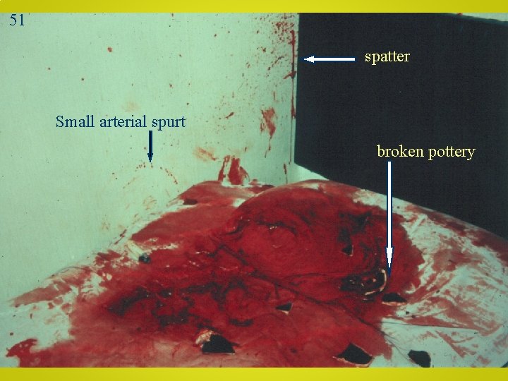 51 spatter Small arterial spurt broken pottery 