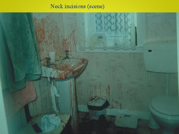 Neck incisions (scene) 