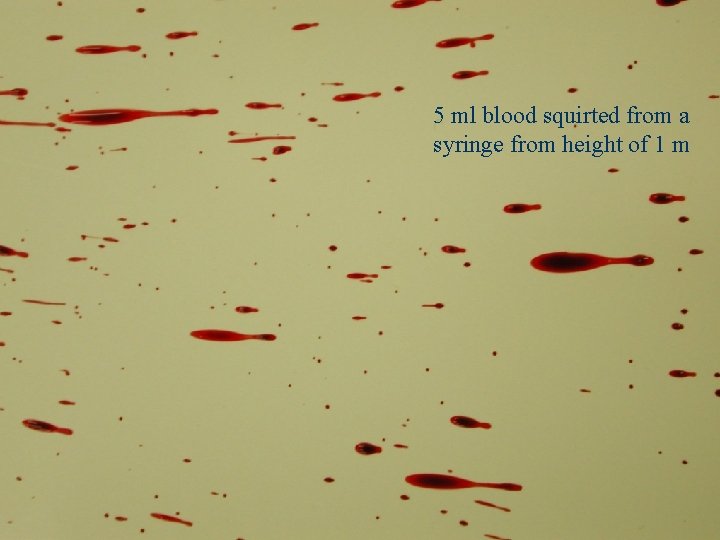 5 ml blood squirted from a syringe from height of 1 m Point of