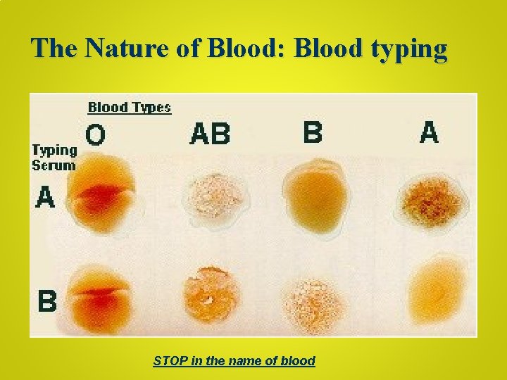 The Nature of Blood: Blood typing STOP in the name of blood 