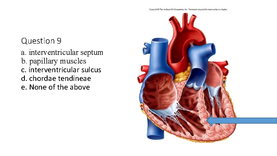 Question 9 a. interventricular septum b. papillary muscles c. interventricular sulcus d. chordae tendineae