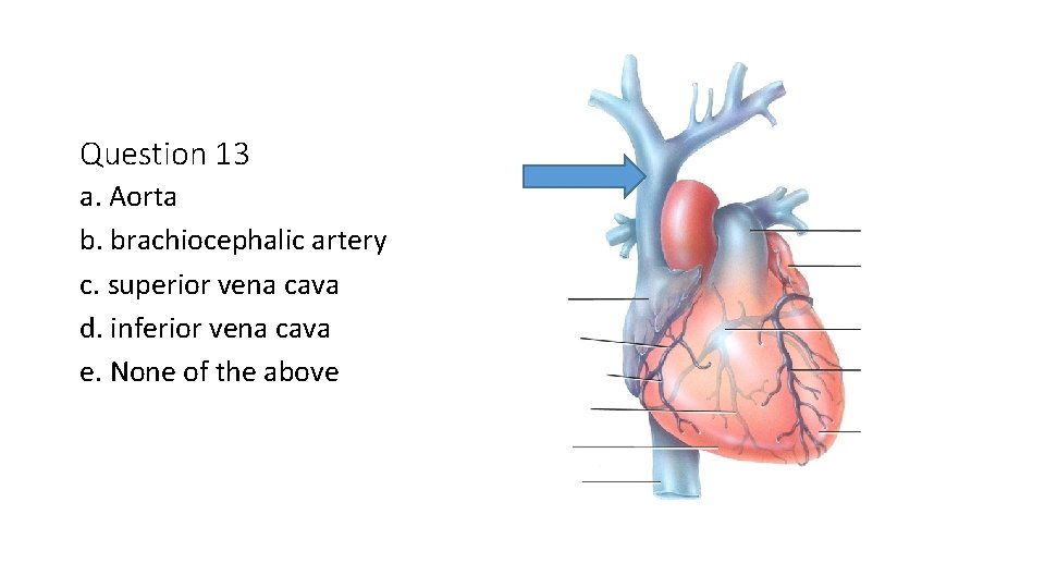 Question 13 a. Aorta b. brachiocephalic artery c. superior vena cava d. inferior vena