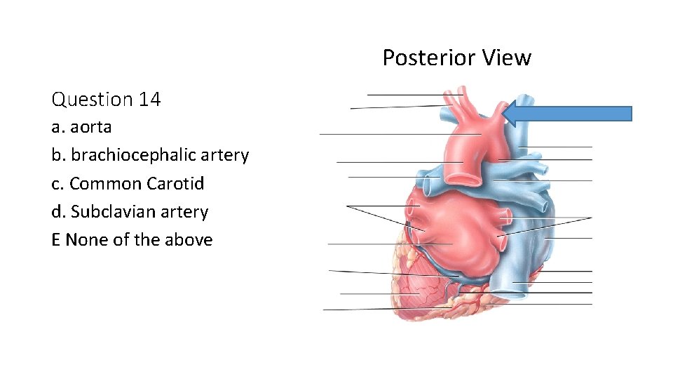 Posterior View Question 14 a. aorta b. brachiocephalic artery c. Common Carotid d. Subclavian