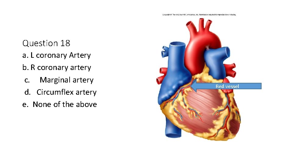 Question 18 a. L coronary Artery b. R coronary artery c. Marginal artery d.