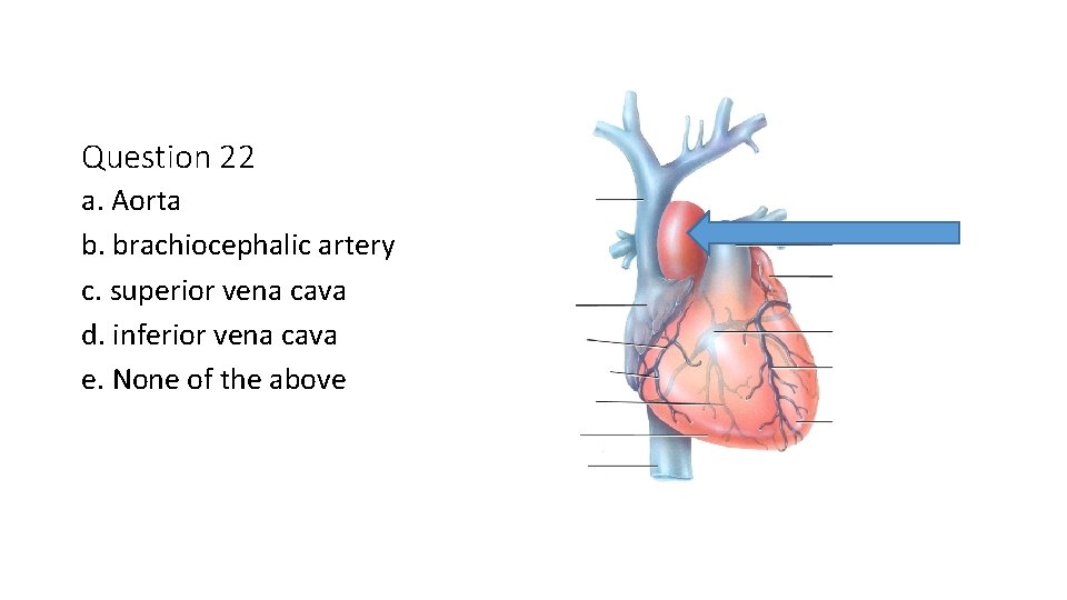 Question 22 a. Aorta b. brachiocephalic artery c. superior vena cava d. inferior vena