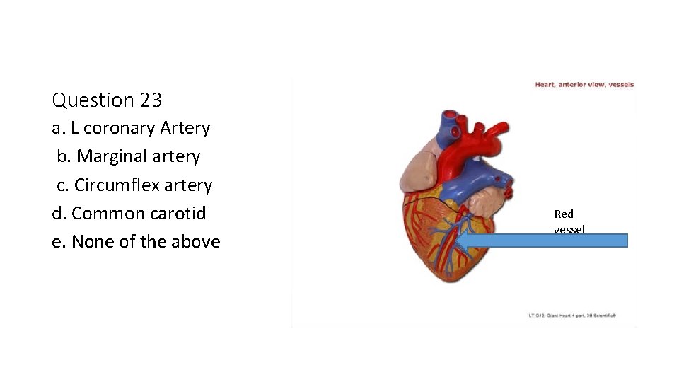 Question 23 a. L coronary Artery b. Marginal artery c. Circumflex artery d. Common