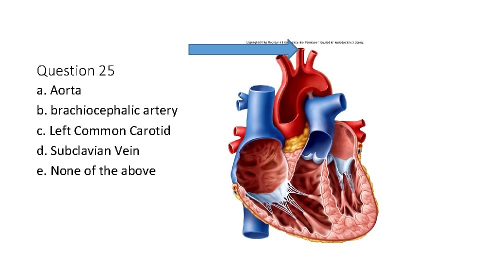 Question 25 a. Aorta b. brachiocephalic artery c. Left Common Carotid d. Subclavian Vein