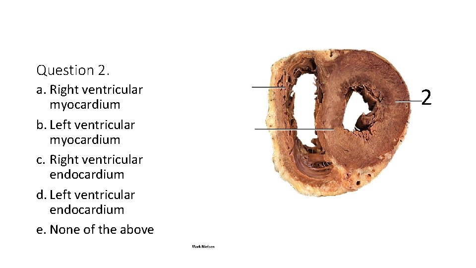 Question 2. a. Right ventricular myocardium b. Left ventricular myocardium c. Right ventricular endocardium