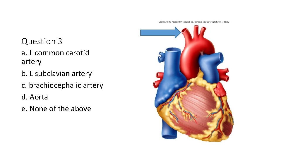 Question 3 a. L common carotid artery b. L subclavian artery c. brachiocephalic artery