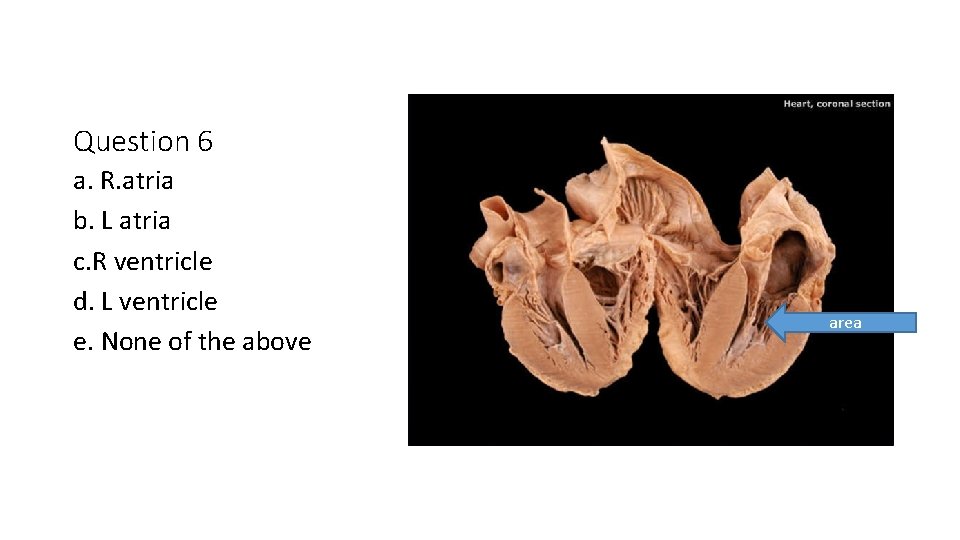 Question 6 a. R. atria b. L atria c. R ventricle d. L ventricle